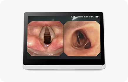 Veterinary Endoscopes